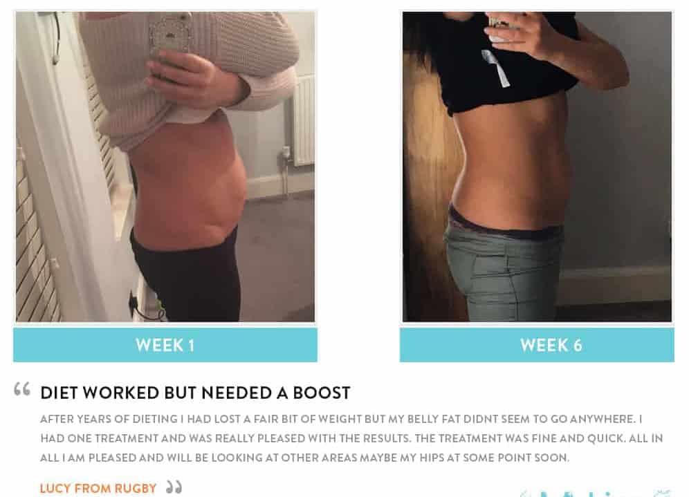 Before and After Dieting Wickford