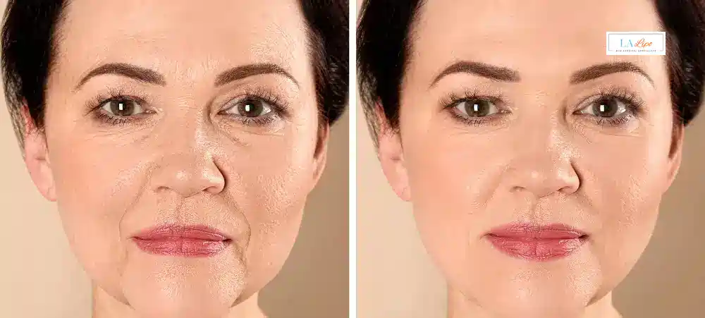 How Long Does It Take to See Results and How Long Do They Last Wickford?